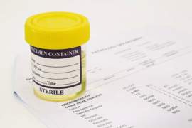  Understanding Urine Tests for BAC