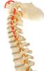 Lesion de la Medula Espinal